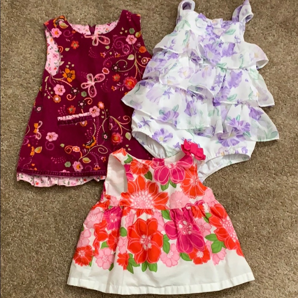Baby dress bundle